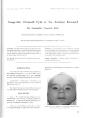 Congenital dermoid