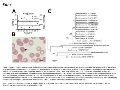 Figure Figure. Laboratory findings of hemorrhagic diathesis in an 18-year-old Somalian refugee to G