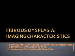 FIBROUS DYSPLASIA: IMAGING CHARACTERISTICS