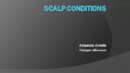 Scalp conditions  Alopecia