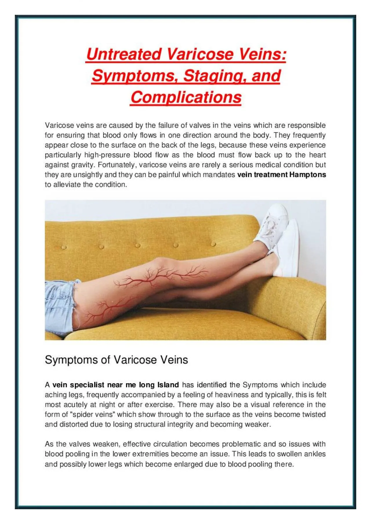 PDF-Untreated Varicose Veins: Symptoms, Staging, and Complications