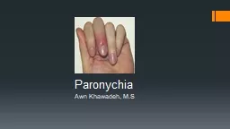 Paronychia Awn  Khawadeh