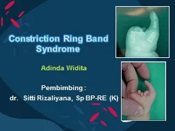 Constriction Ring Band Syndrome
