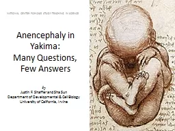 Anencephaly in Yakima:  Many Questions, Few Answers