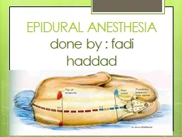 EPIDURAL   ANESTHESIA done by :