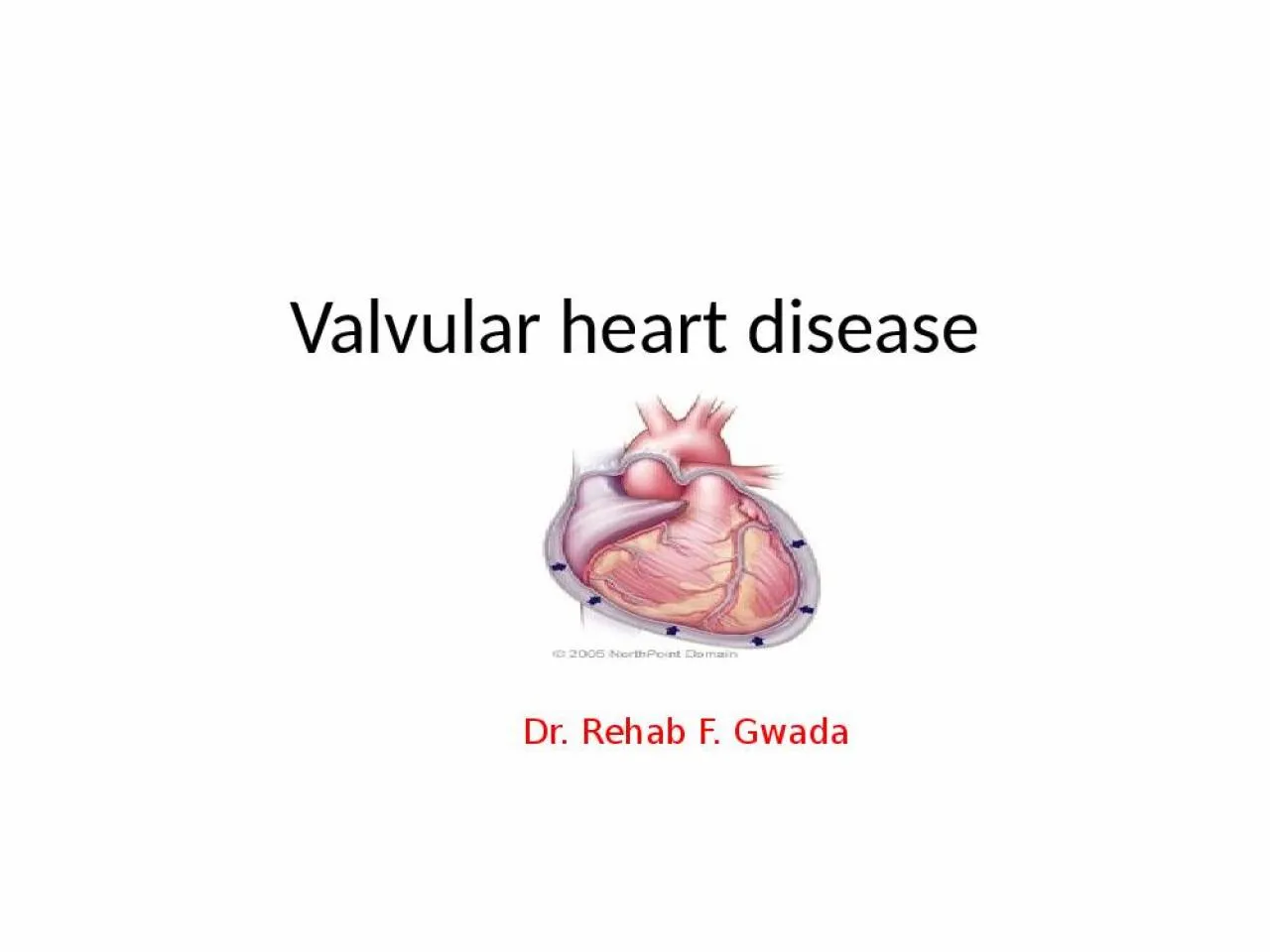 PPT-Valvular heart disease Dr. Rehab F.