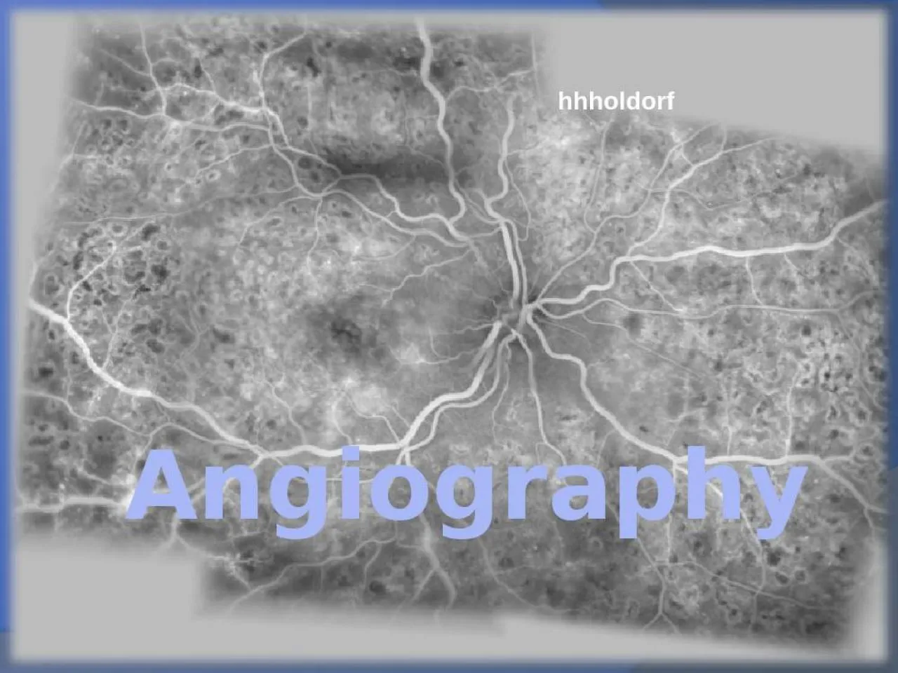 PPT-Angiography hhholdorf