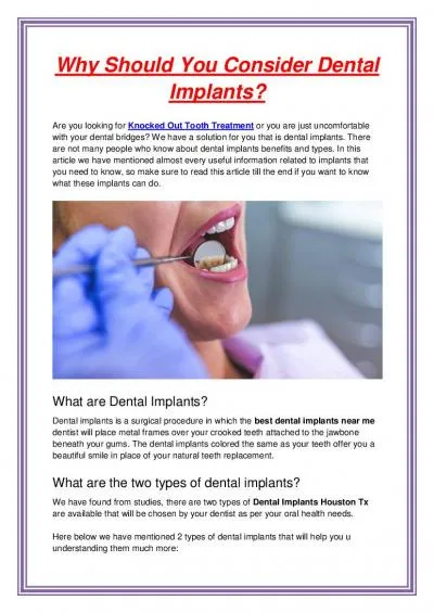 Why Should You Consider Dental Implants?