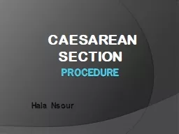 Procedure    CAESAREAN    SECTION