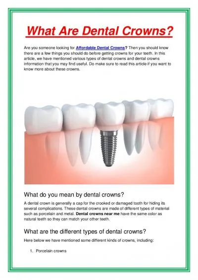 What Are Dental Crowns?