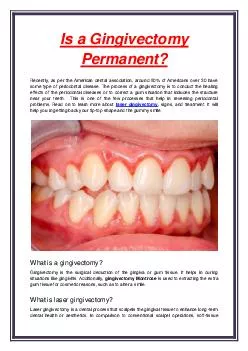 Is a Gingivectomy Permanent?