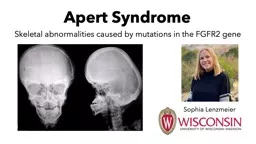 PPT-Apert Syndrome Skeletal abnormalities caused by mutations in the FGFR2 gene