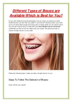 Different Types of Braces are Available Which is Best for You?