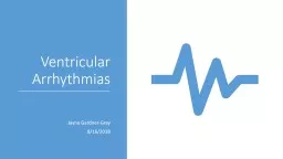 Ventricular Arrhythmias Jayna Gardner-Gray