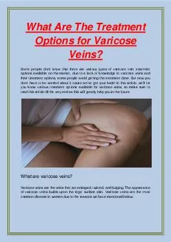 What Are The Treatment Options for Varicose Veins?