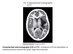 PPT-Computerized axial tomography (CAT or CT)