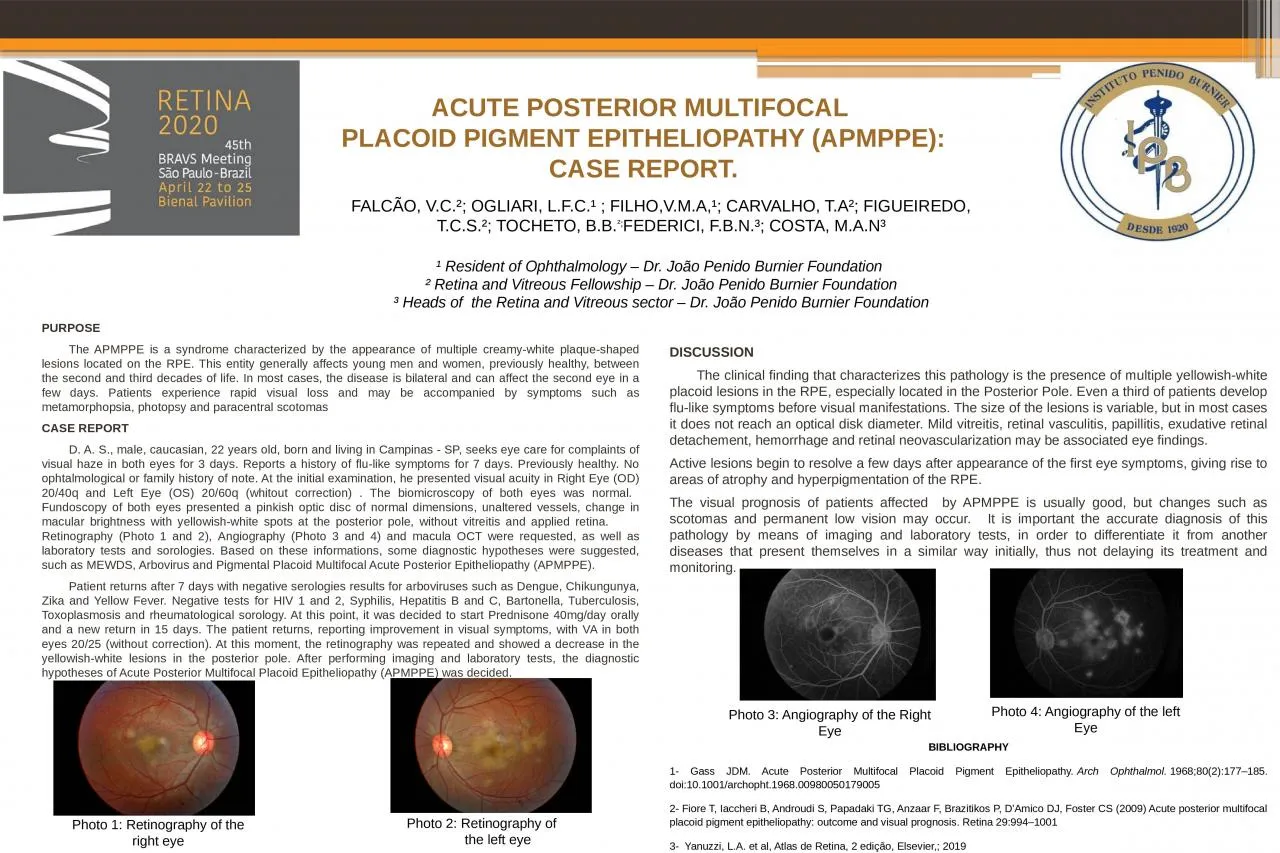 PPT-PURPOSE The APMPPE is a syndrome characterized by the appearance of multiple creamy-white