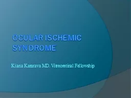 Ocular Ischemic Syndrome