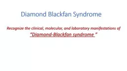 Diamond- Blackfan  Anemia