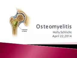 PPT-Osteomyelitis Holly Schlicht