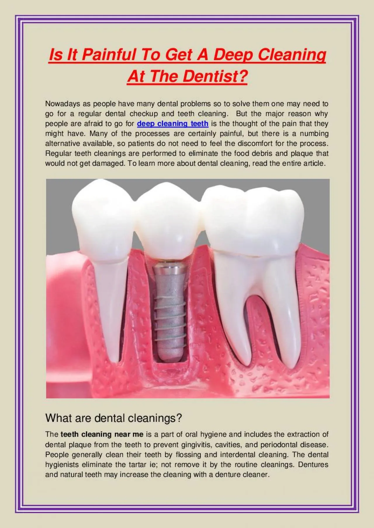 PDF-Is It Painful To Get A Deep Cleaning At The Dentist?