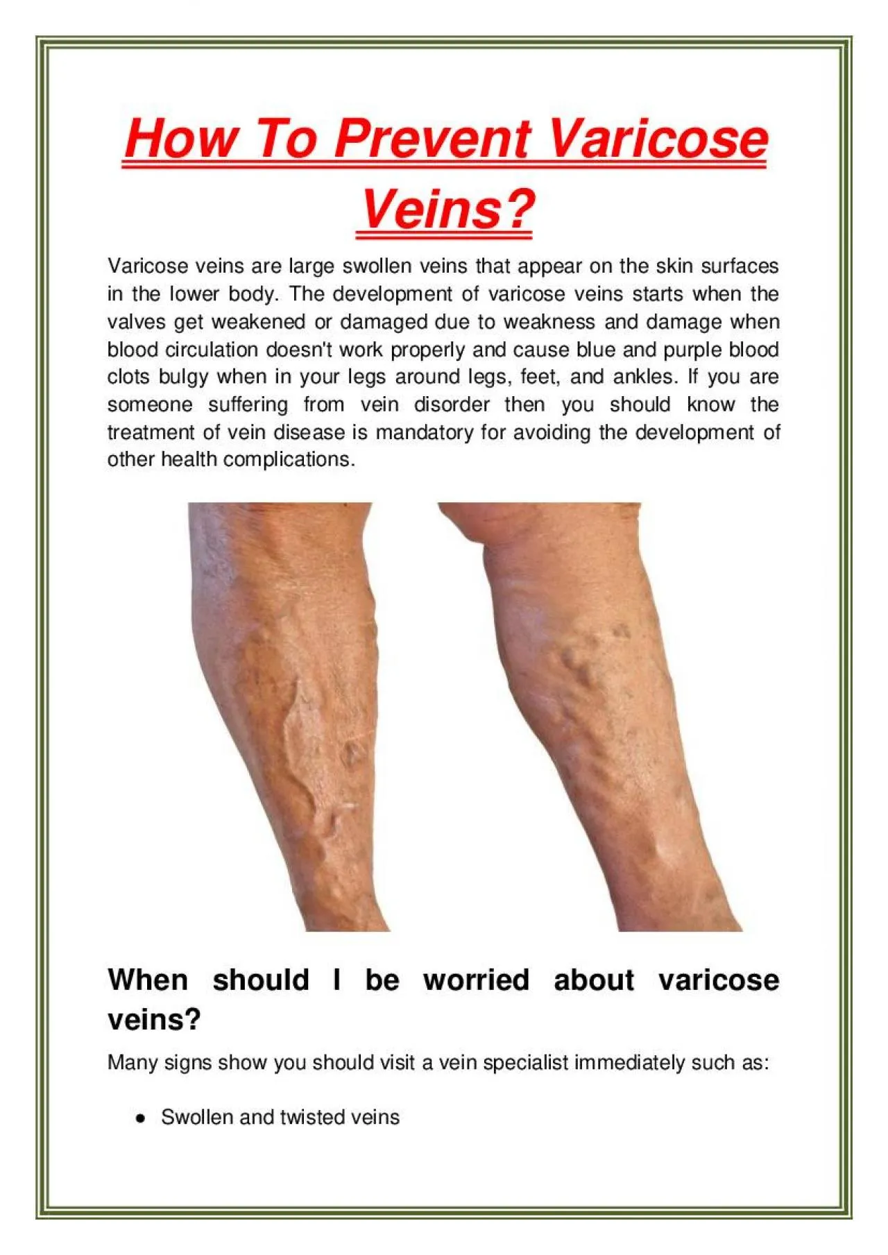 PDF-How To Prevent Varicose Veins?