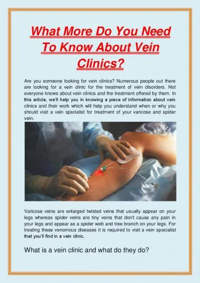 What More Do You Need To Know About Vein Clinics?