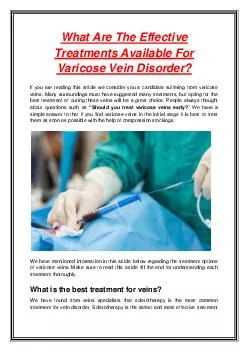 What Are The Effective Treatments Available For Varicose Vein Disorder?