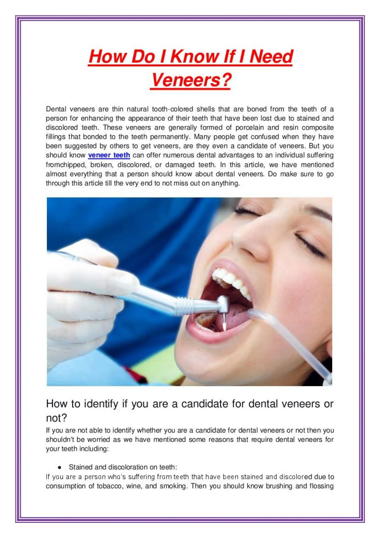 PDF-How Do I Know If I Need Veneers?