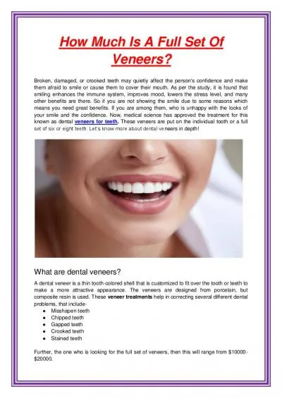 How Much Is A Full Set Of Veneers?