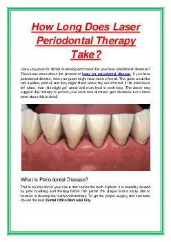 How Long Does Laser Periodontal Therapy Take?