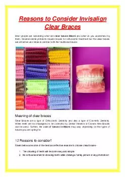Reasons to Consider Invisalign Clear Braces