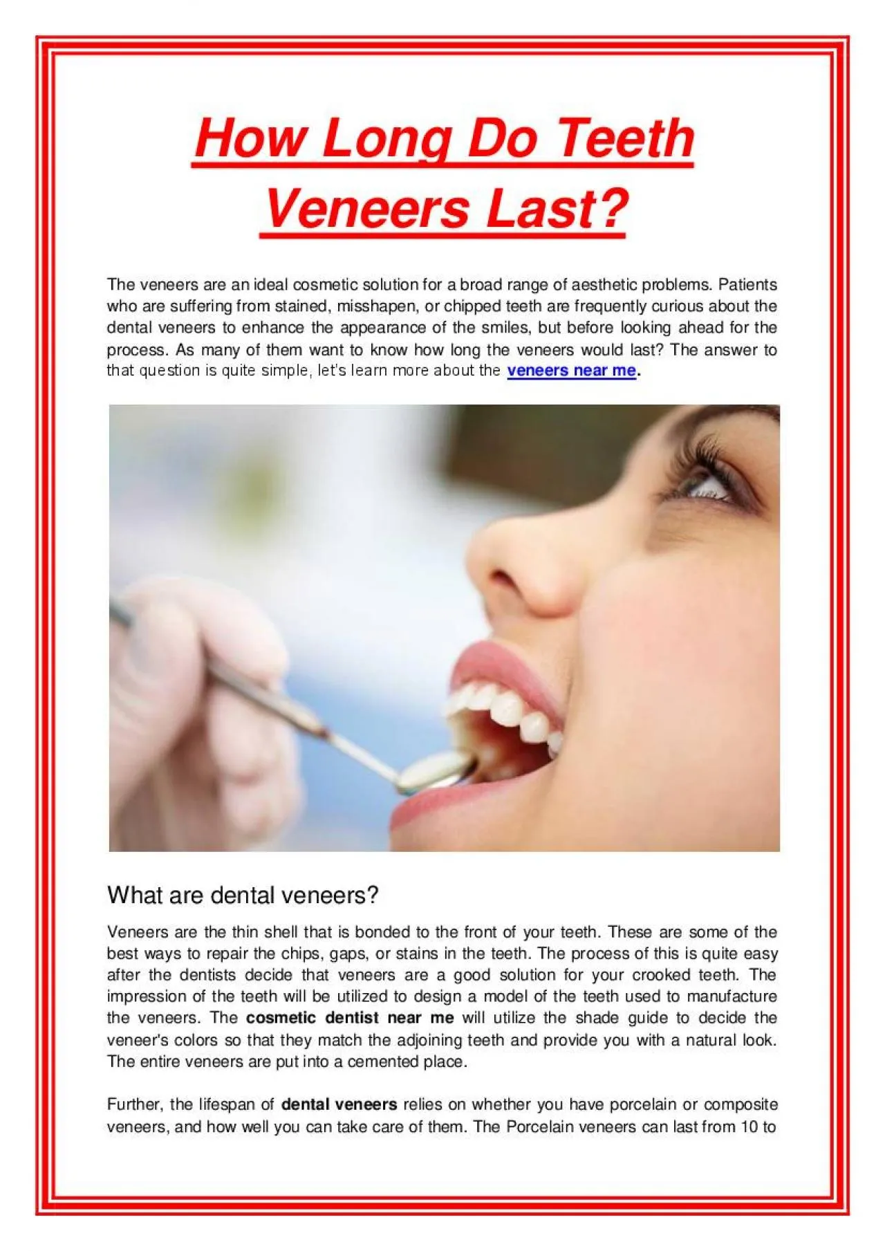 PDF-How Long Do Teeth Veneers Last?