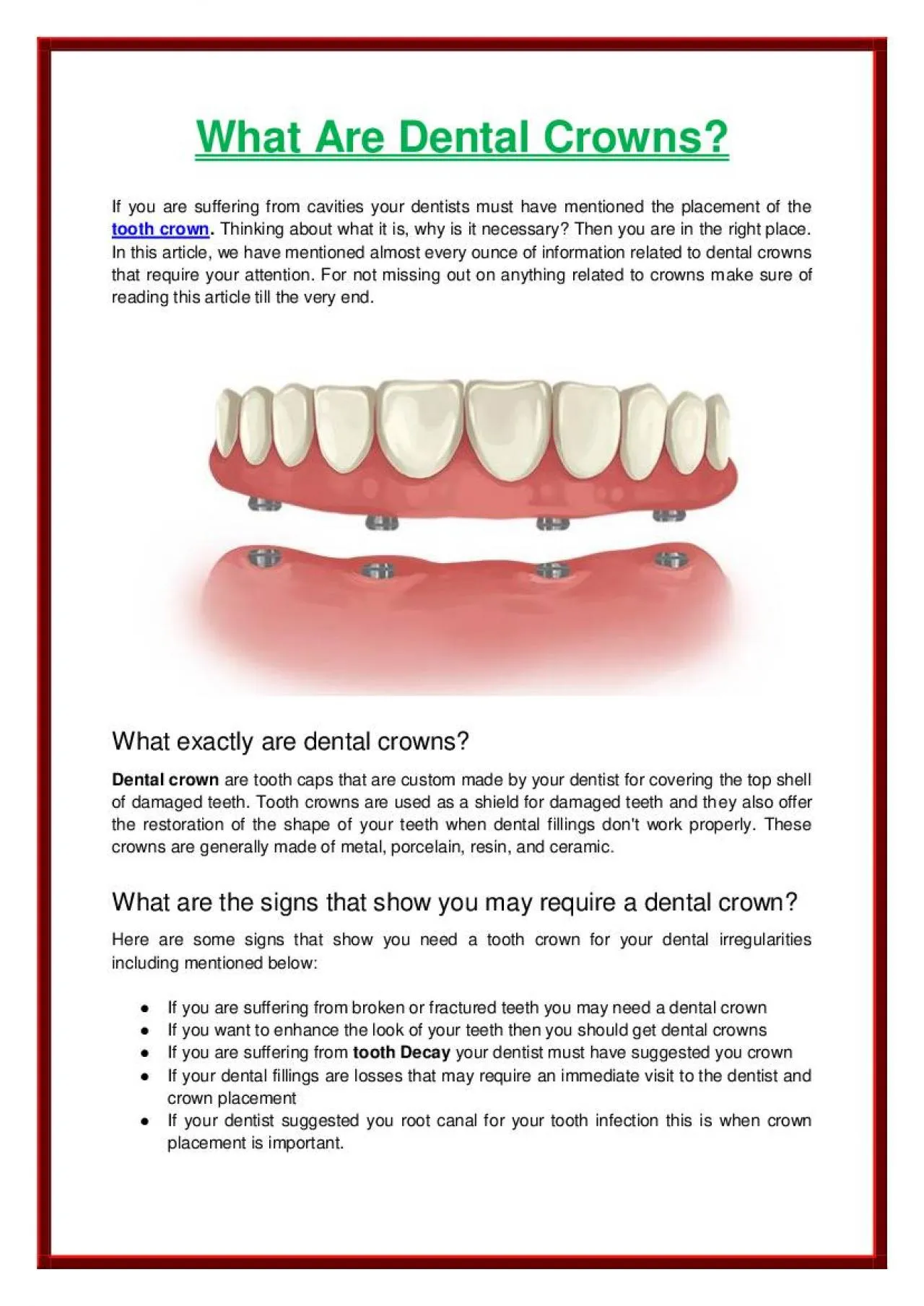 PDF-What Are Dental Crowns?