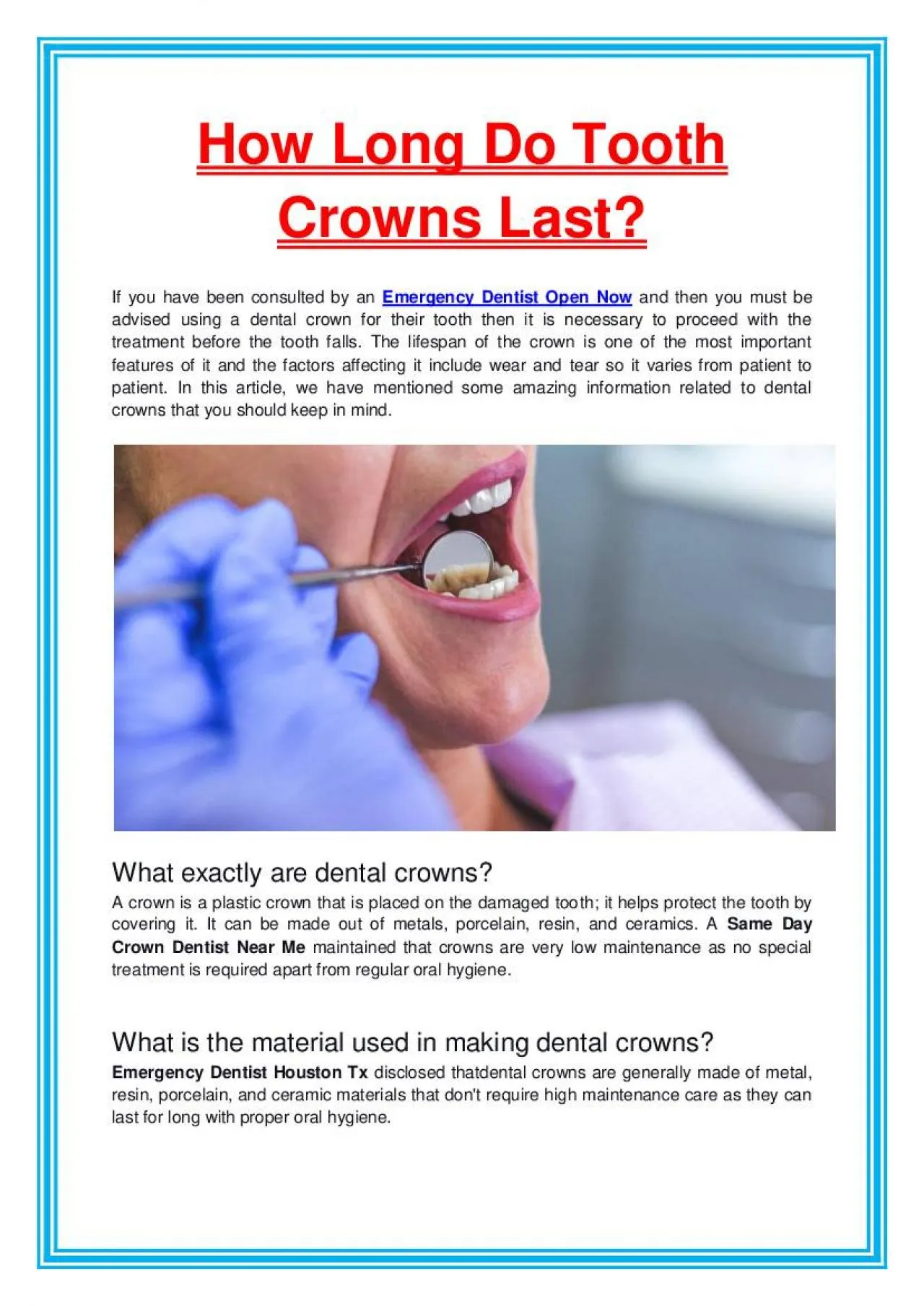 PDF-How Long Do Tooth Crowns Last?