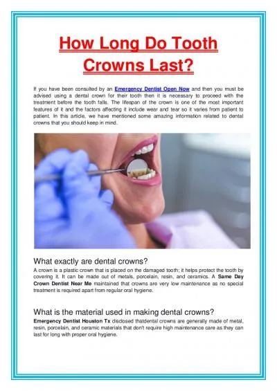 How Long Do Tooth Crowns Last?