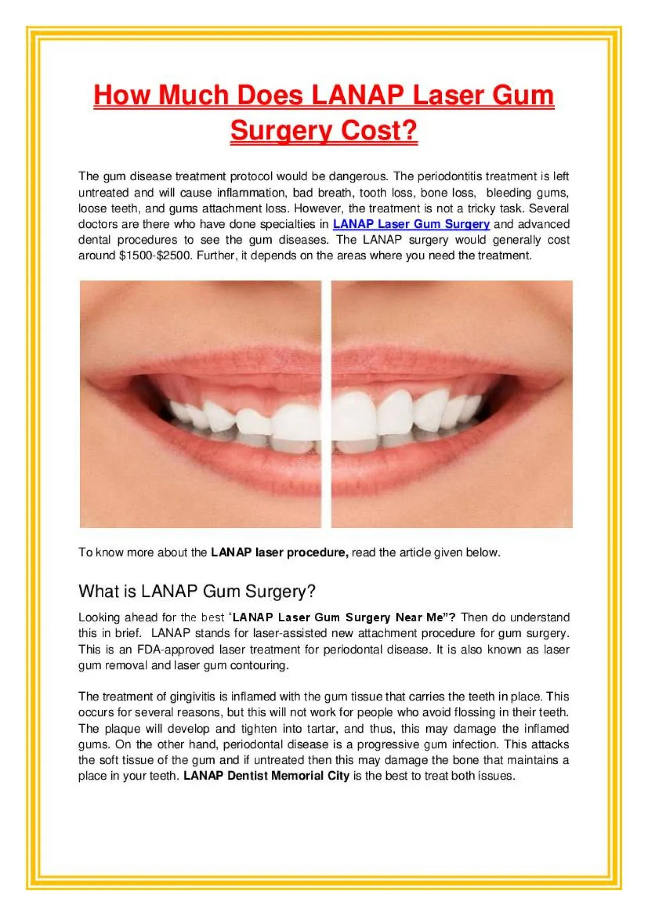 PDF-How Much Does LANAP Laser Gum Surgery Cost?