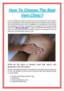 How To Choose The Best Vein Clinic?