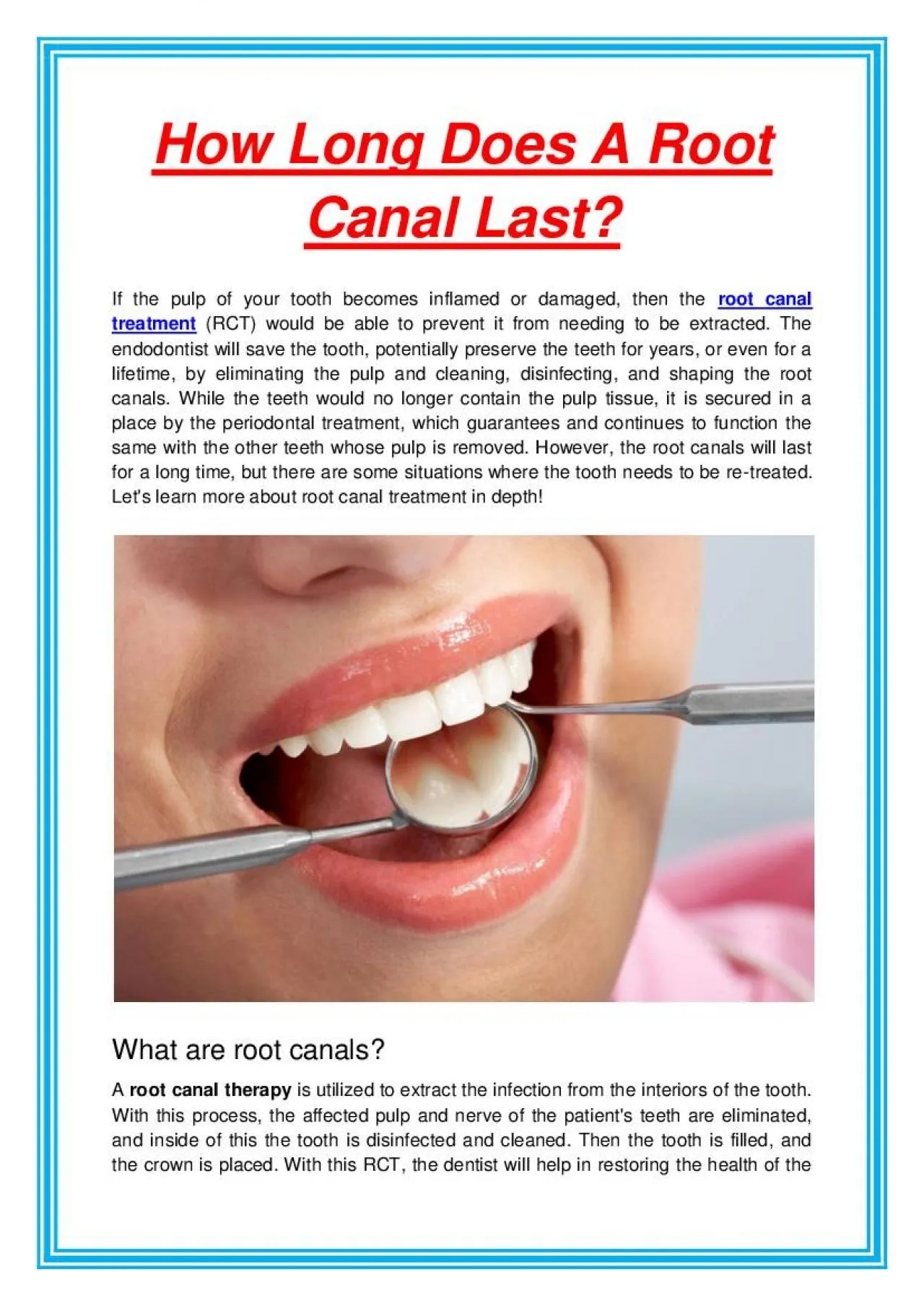 PDF-How Long Does A Root Canal Last?