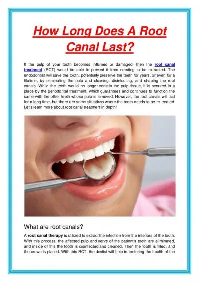 How Long Does A Root Canal Last?