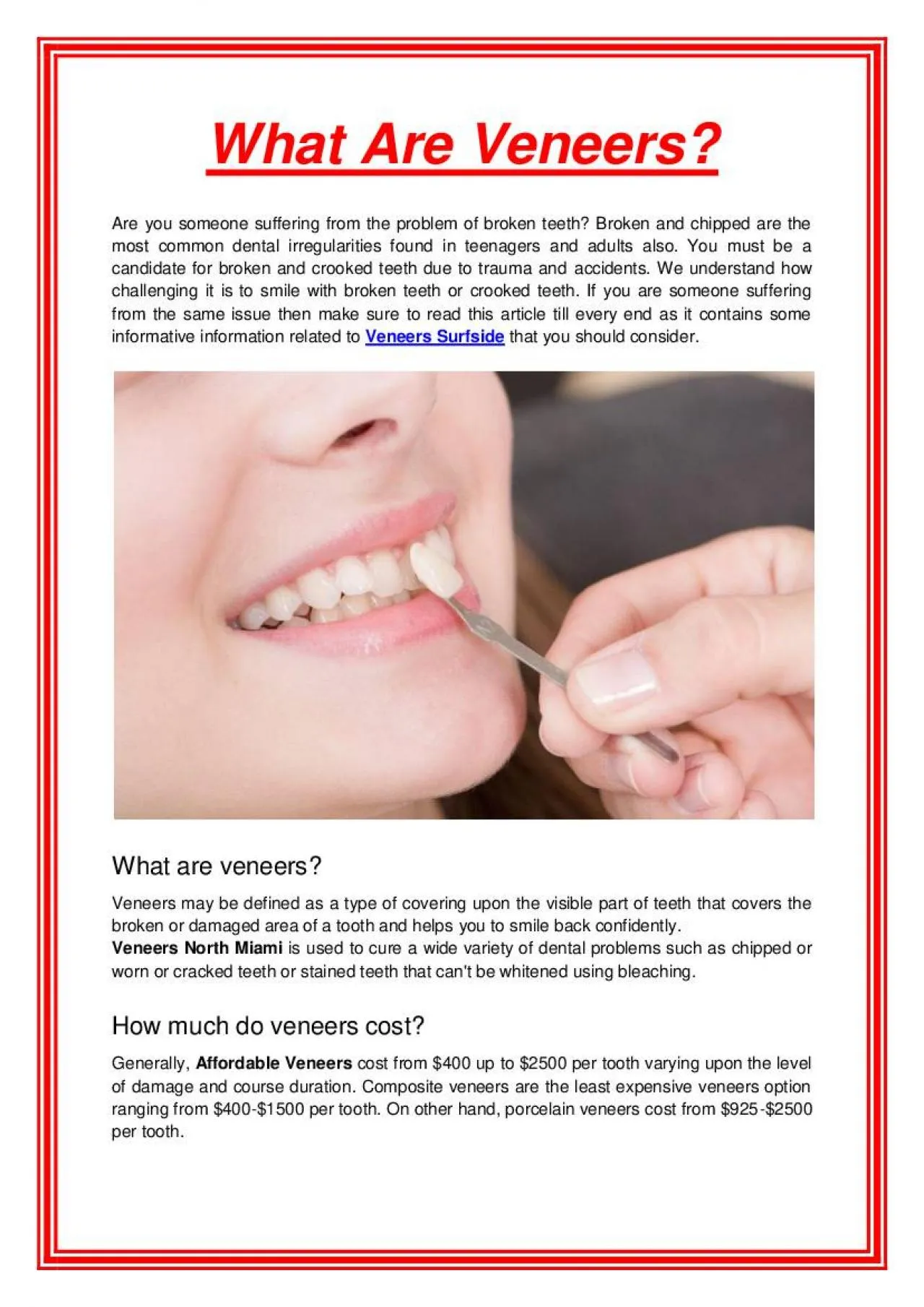 PDF-What Are Veneers?