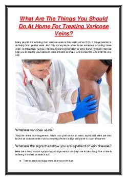What Are The Things You Should Do At Home For Treating Varicose Veins?