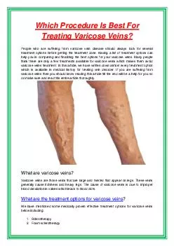 Which Procedure Is Best For Treating Varicose Veins?