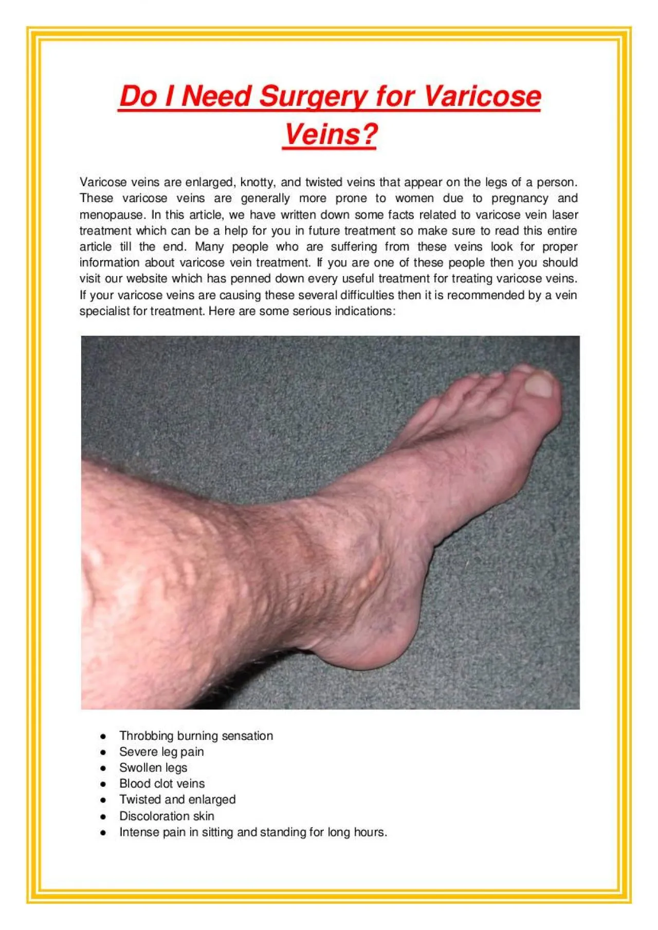 PDF-Do I Need Surgery for Varicose Veins?