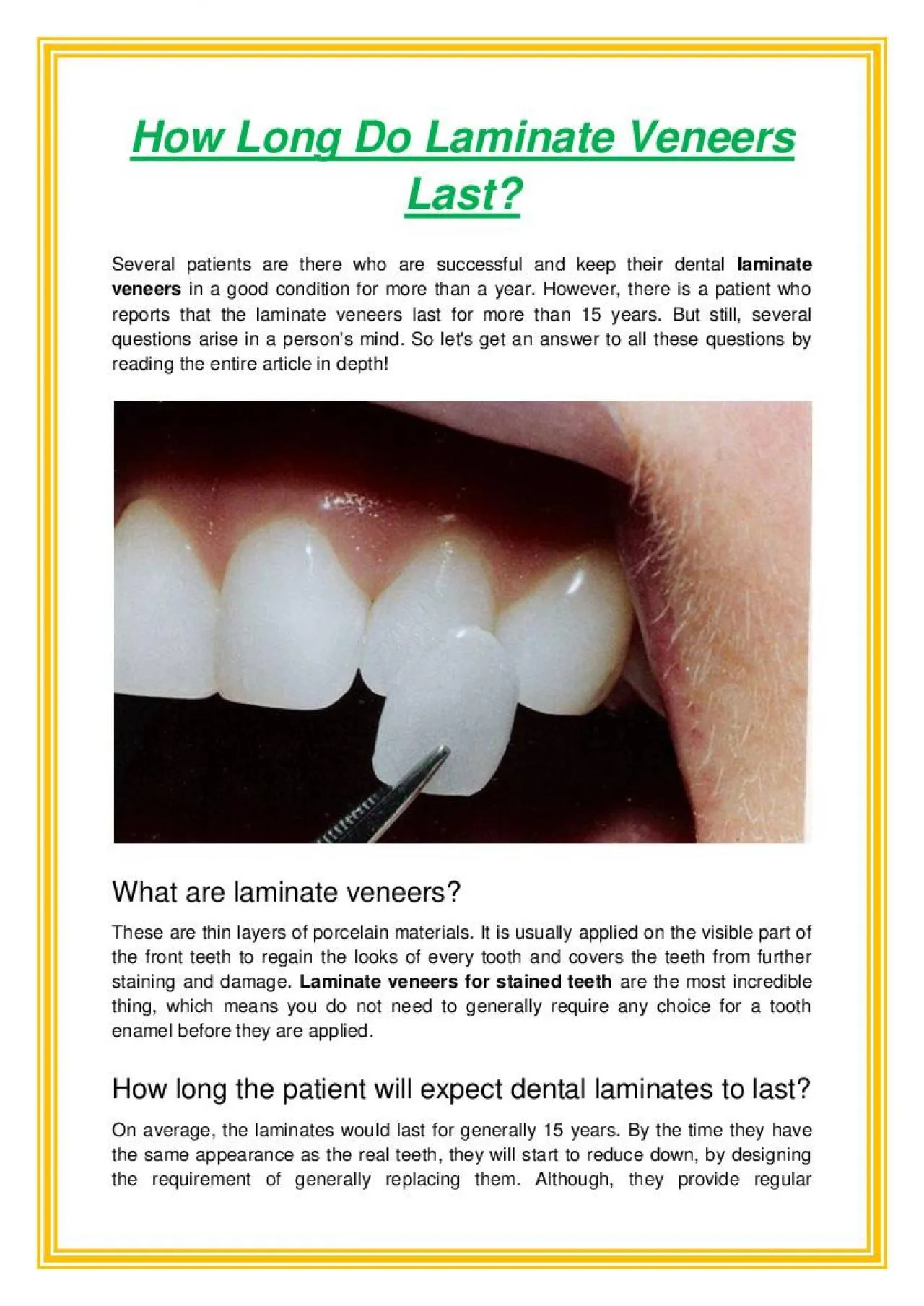 PDF-How Long Do Laminate Veneers Last?