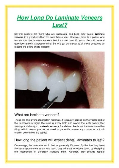 How Long Do Laminate Veneers Last?