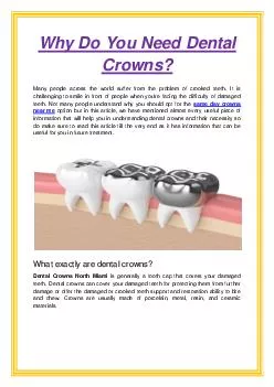 Why Do You Need Dental Crowns?