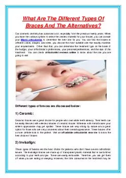 What Are The Different Types Of Braces And The Alternatives?