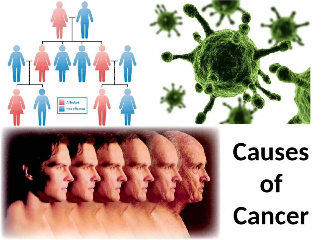 PPT-Causes of Cancer Ageing Most types of cancer become more common as people age