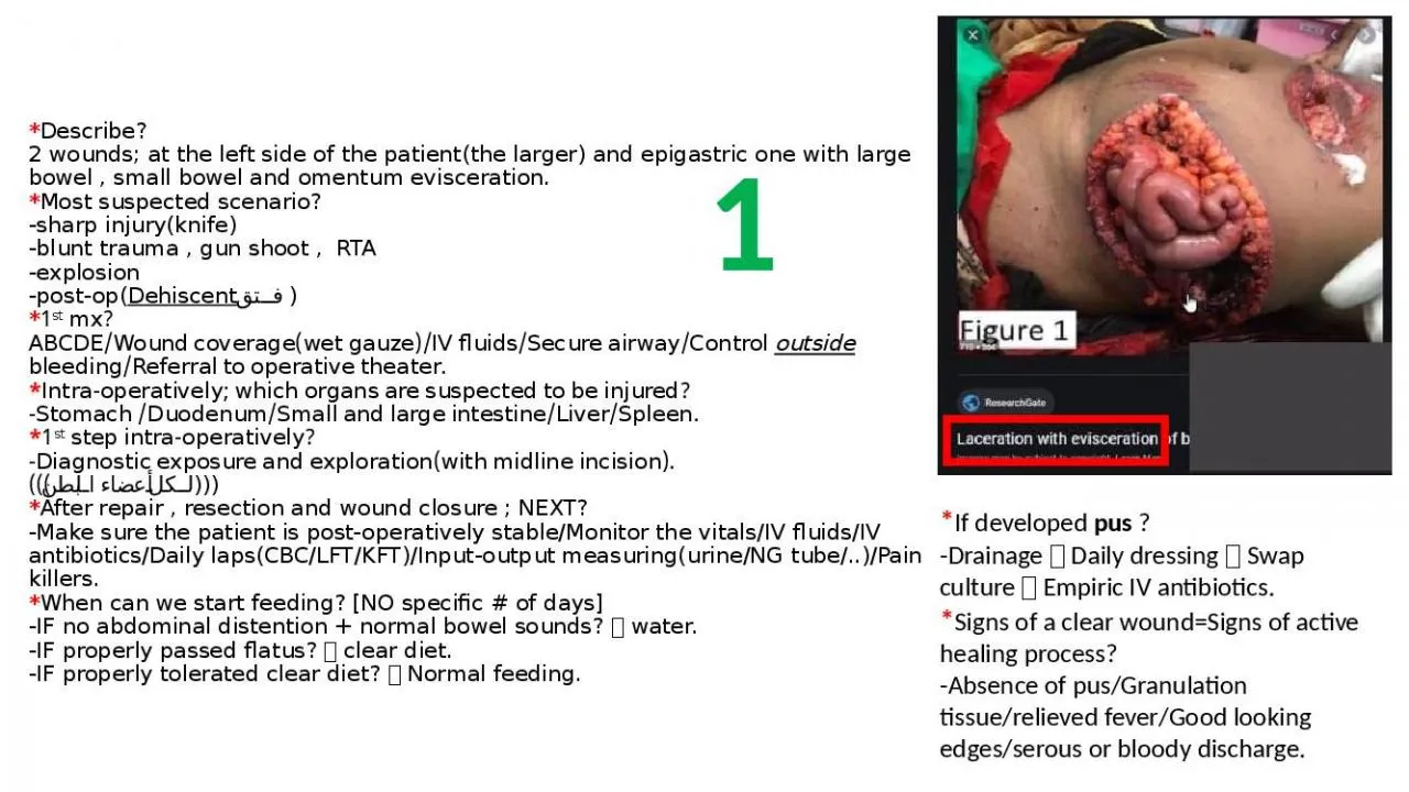 PPT-* Describe? 2 wounds; at the left side of the patient(the larger) and epigastric one with